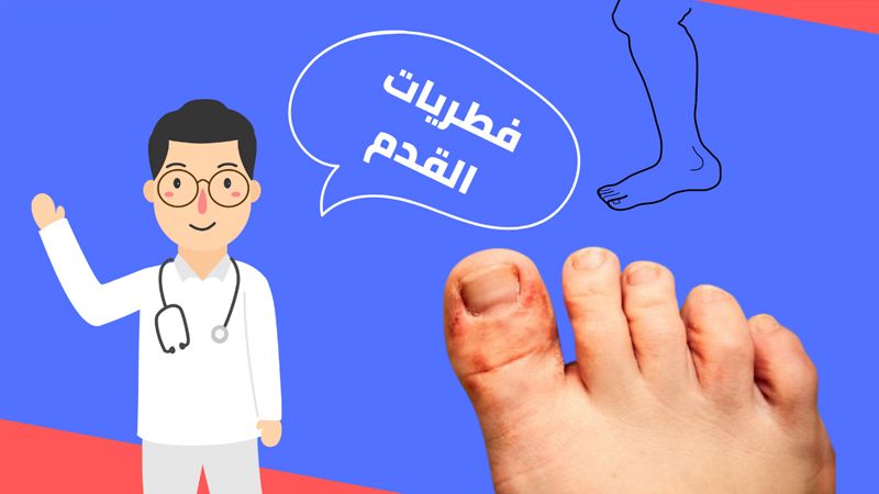 الحكة بين أصابع القدم.. الأسباب والعلاج‬